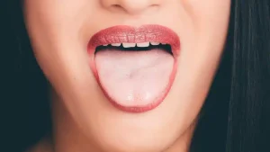 Risikofaktoren für Mundkrebs