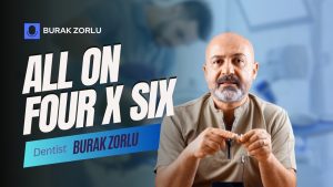 Antalya All on 6 – Advanced Dental Implant Solutions