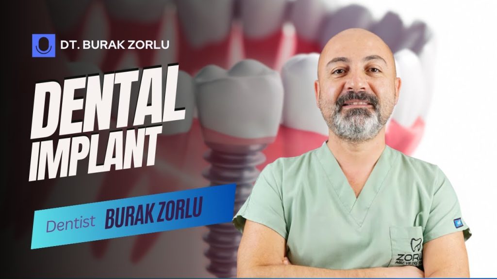 Dental Implants in Antalya