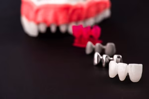 Different Types of Dental Implants: The Complete 2026 Patient Guide