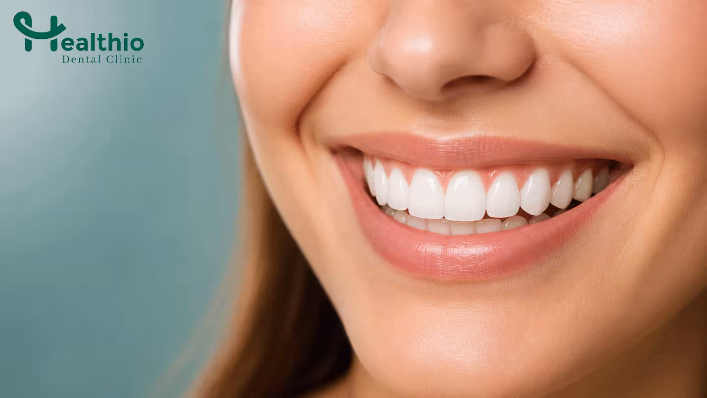 Composite Bonding Aftercare