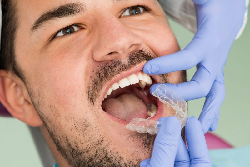 Orthodontist placing invisible braces to patient's mouth