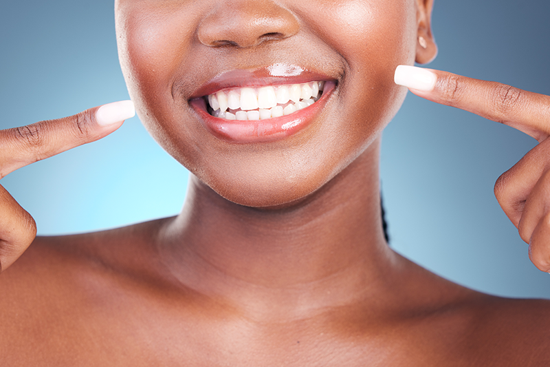 Teeth Whitining Antalya